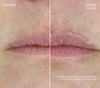 Ourself Before and Afters Lip . Subjet x bbea fc db b bbfd x crop center@x