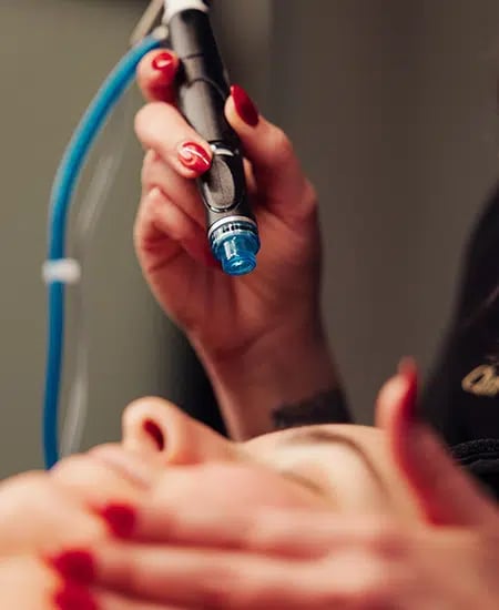 woman receiving hydrafacial treatment at bcrn x woman receiving hydrafacial treatment at bcrn x
